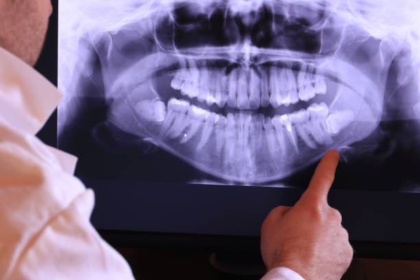 Best Emergency Dental Care for Broken or Chipped Teeth in Concord, VA