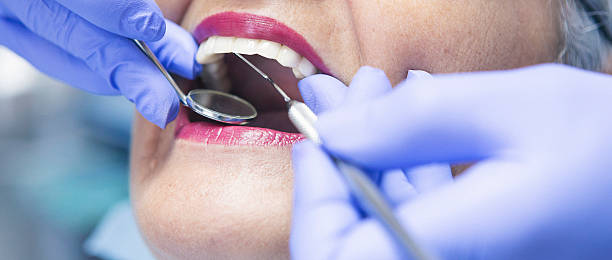 Best Emergency Tooth Extraction in Concord, VA
